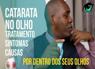Catarata no Olho: Tratamento, Sintomas e Causas
