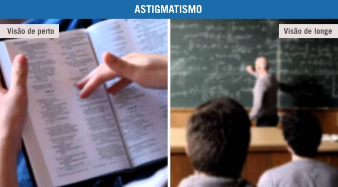 Astigmatismo